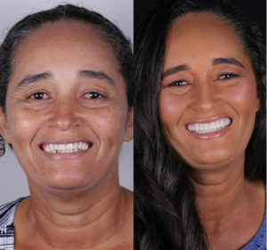 arpe_site-(1)_0002s_0002s_0001_PHOTO-2024-08-19-18-56-55